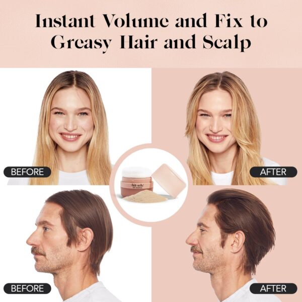 Dry Shampoo - Image 2
