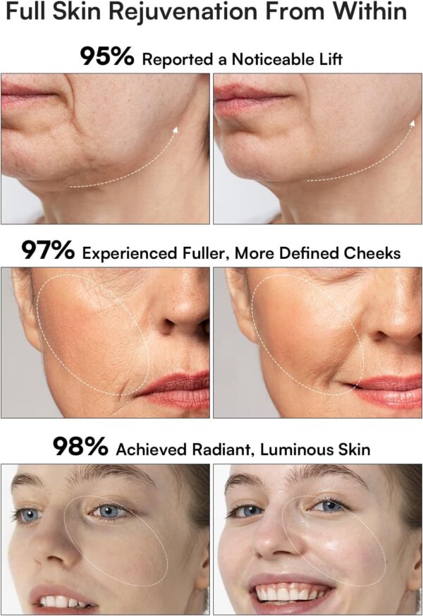 Beauty Device - Image 3
